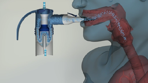 pari雾化机怎么使用你加购的雾化杯，选对了吗？_https://www.jmylbn.com_新闻资讯_第18张