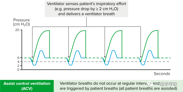什么是有创呼吸机图片【机械通气】有创通气的模式_https://www.jmylbn.com_新闻资讯_第2张