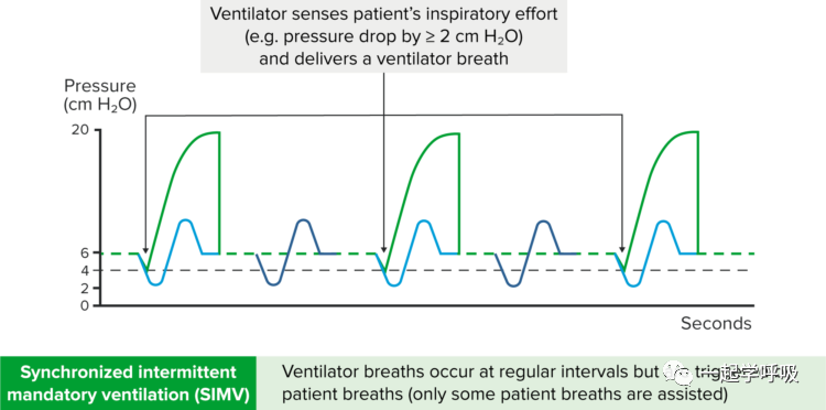 什么是有创呼吸机图片【机械通气】有创通气的模式_https://www.jmylbn.com_新闻资讯_第3张