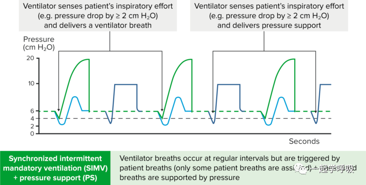 什么是有创呼吸机图片【机械通气】有创通气的模式_https://www.jmylbn.com_新闻资讯_第4张