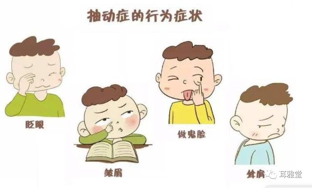 华佗磁疗贴怎么样耳穴放血联合耳穴磁疗对小儿多发性抽动症疗效果显著_https://www.jmylbn.com_新闻资讯_第6张