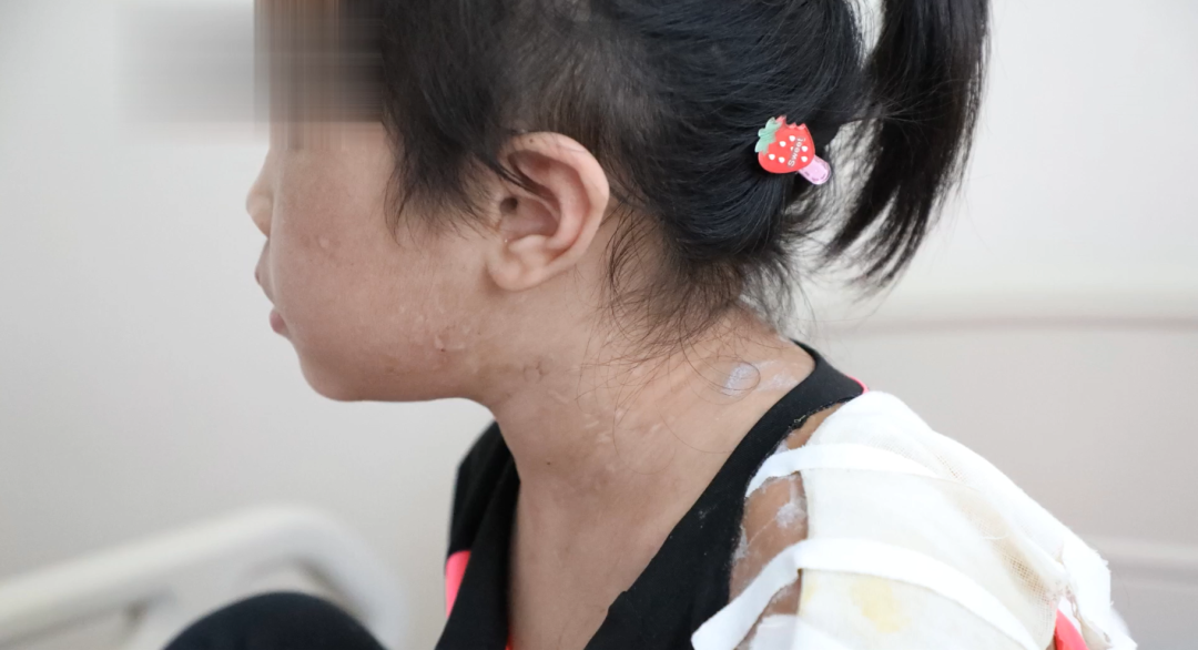 检察官讲起这一虐童案眼里含泪-中国长安网