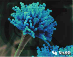 过敏原（29项）检测临床意义及常见问题