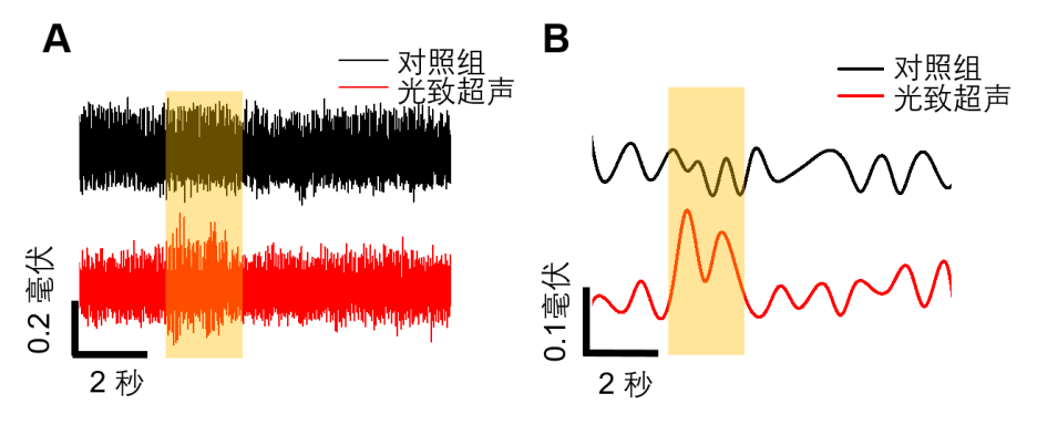 Light | 超高精度光致超声无创神经刺激技术的图4