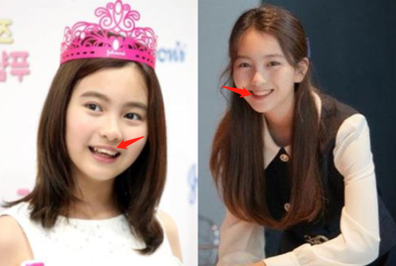 【美女】曾经全网为她哭瞎眼，如今带着一张惊艳众人的脸杀回来了「组图」 - 44