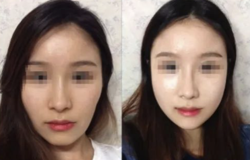 南韩鞠婧祎被舔上神颜宝座 是欺负没人知道她挨过整形医生4000刀吗 新氧微信公众号文章