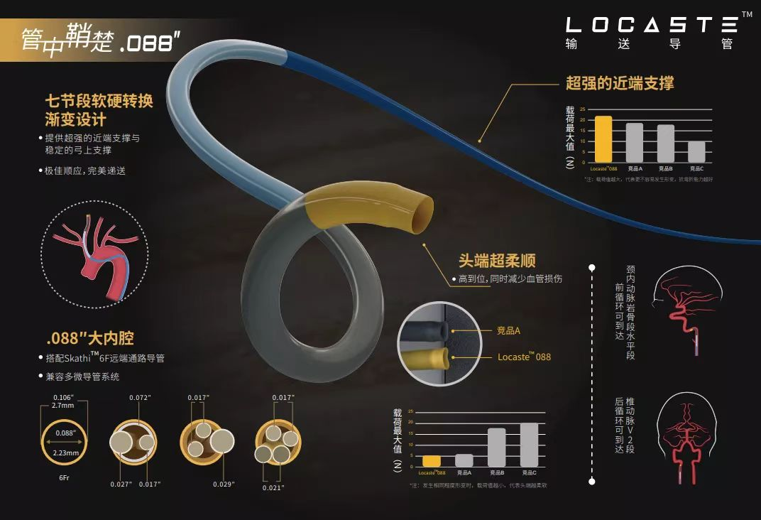 动脉长鞘怎么置入有励可说｜Locaste 088励楷长鞘及Tarvos微导丝在右侧大脑中动脉M2段取栓术中的应用_https://www.jmylbn.com_新闻资讯_第24张