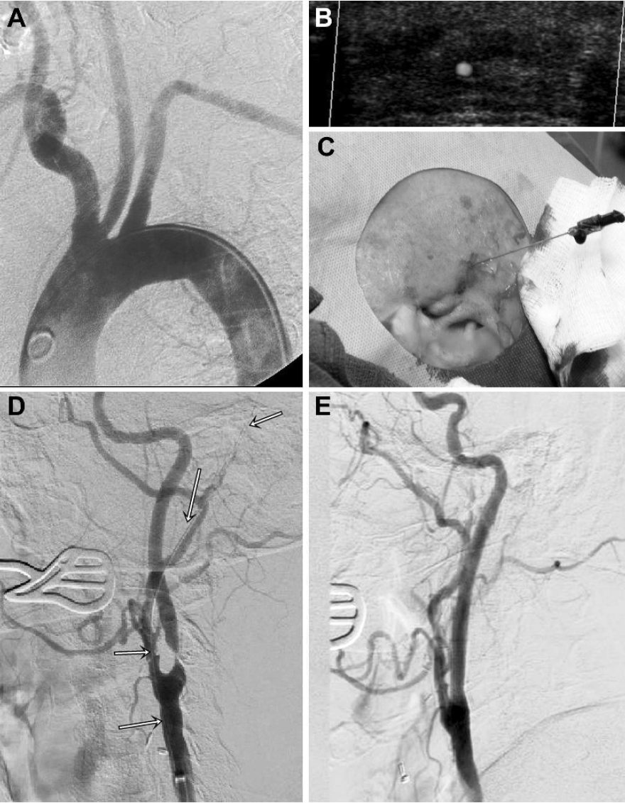 泥鳅导丝怎么用宣武CRC星期五｜CAS遇天堑，如何变通途？_https://www.jmylbn.com_新闻资讯_第8张