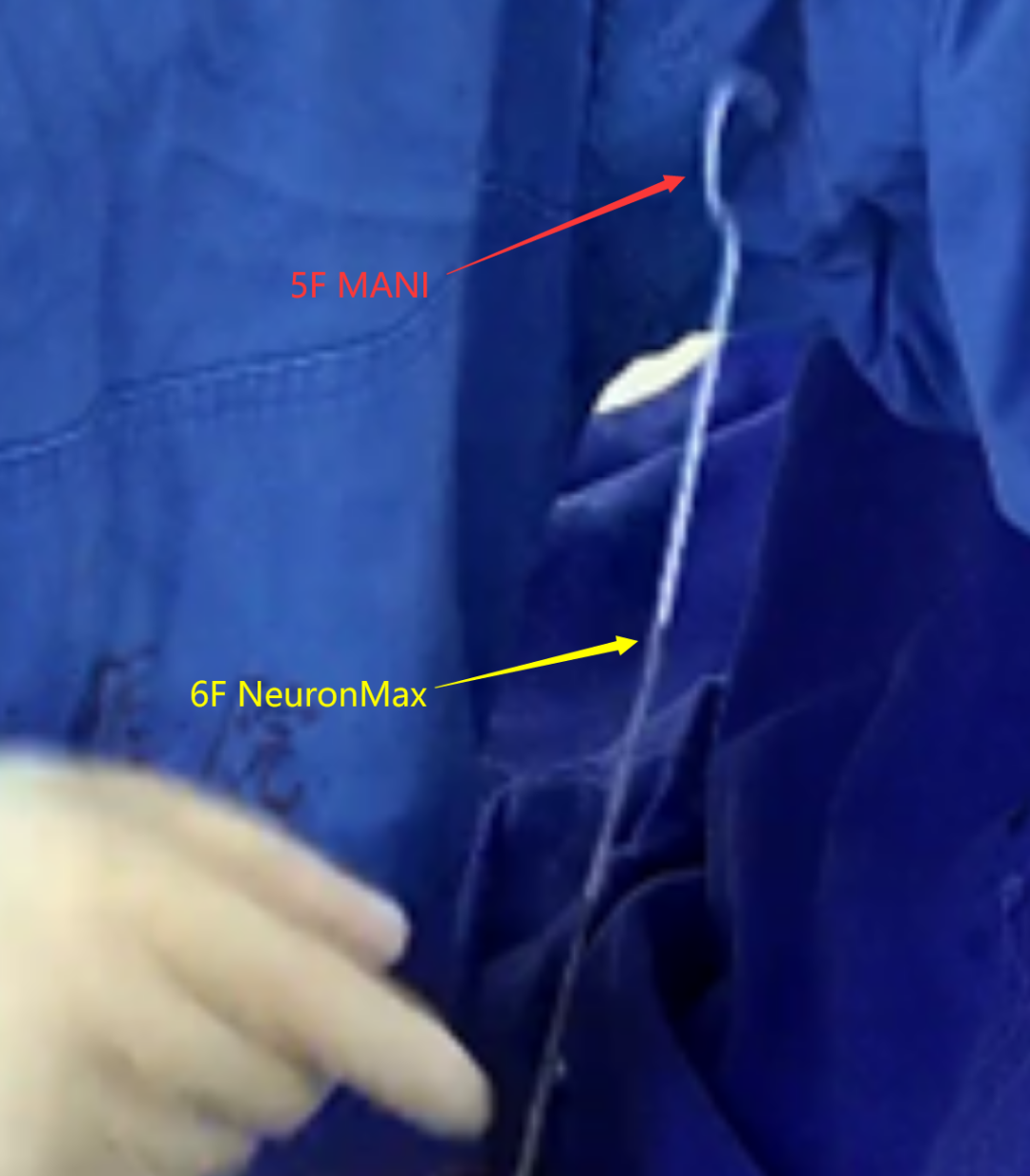 泥鳅导丝怎么用宣武CRC星期五｜CAS遇天堑，如何变通途？_https://www.jmylbn.com_新闻资讯_第5张