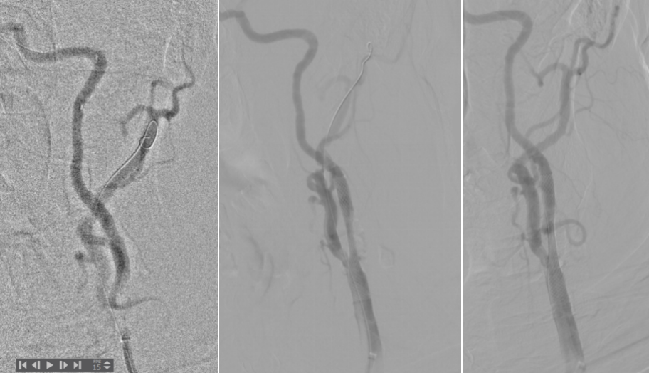 泥鳅导丝怎么用宣武CRC星期五｜CAS遇天堑，如何变通途？_https://www.jmylbn.com_新闻资讯_第6张