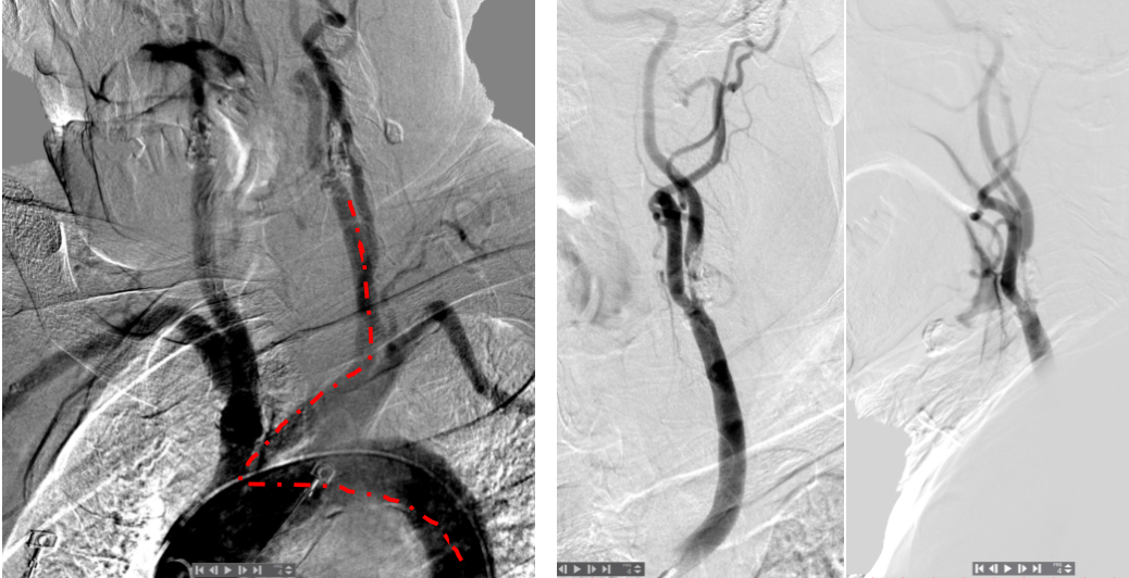 泥鳅导丝怎么用宣武CRC星期五｜CAS遇天堑，如何变通途？_https://www.jmylbn.com_新闻资讯_第3张