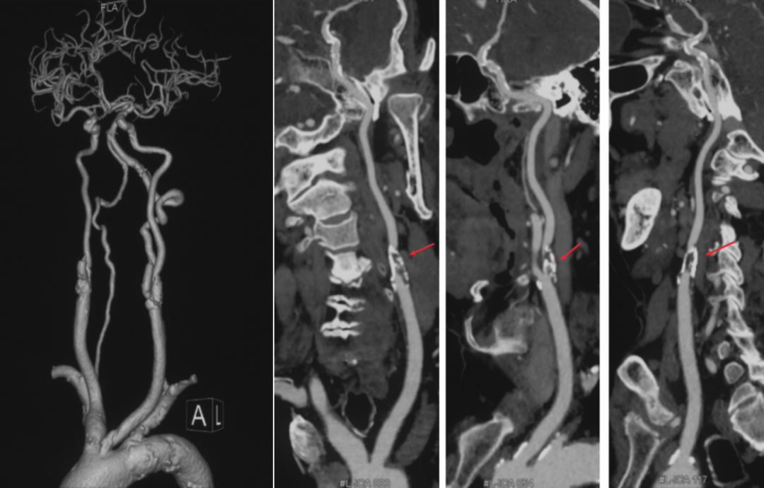 泥鳅导丝怎么用宣武CRC星期五｜CAS遇天堑，如何变通途？_https://www.jmylbn.com_新闻资讯_第2张