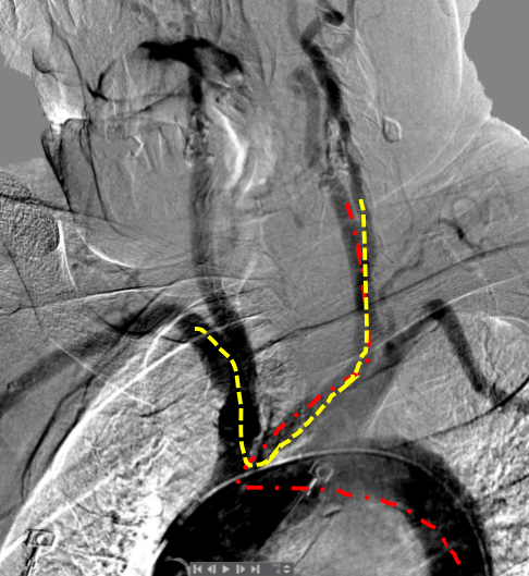 泥鳅导丝怎么用宣武CRC星期五｜CAS遇天堑，如何变通途？_https://www.jmylbn.com_新闻资讯_第7张
