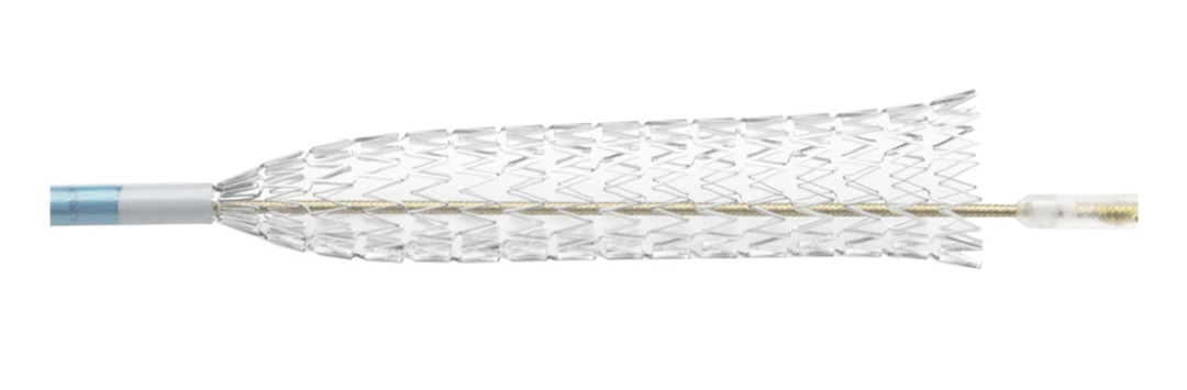 波科支架怎么样波科收购Silk Road Medical，经颈动脉血运重建术（TCAR）在中国前景几何？_https://www.jmylbn.com_新闻资讯_第3张