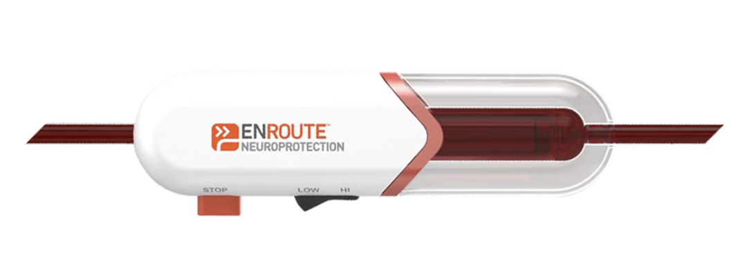 波科支架怎么样波科收购Silk Road Medical，经颈动脉血运重建术（TCAR）在中国前景几何？_https://www.jmylbn.com_新闻资讯_第2张