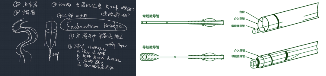 为什么要用到微导管介入面对迂曲  创新循迹导航——导航微导管初体验_https://www.jmylbn.com_新闻资讯_第7张