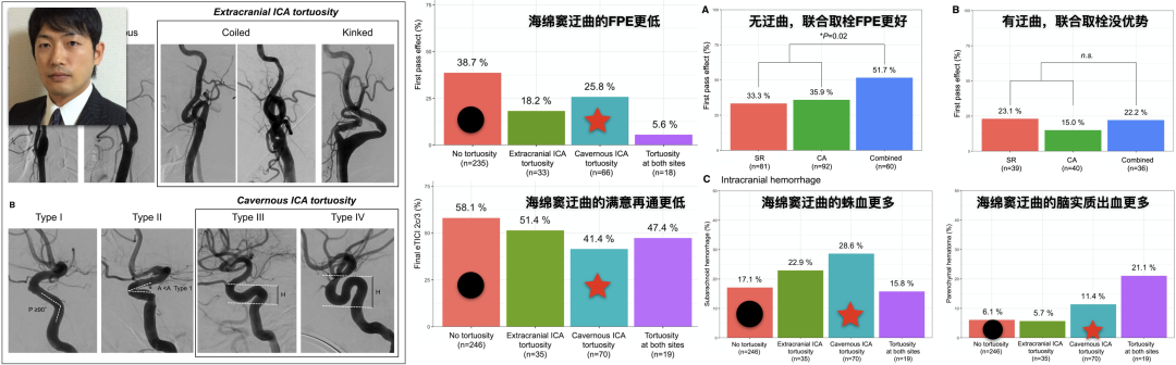 为什么要用到微导管介入面对迂曲  创新循迹导航——导航微导管初体验_https://www.jmylbn.com_新闻资讯_第4张