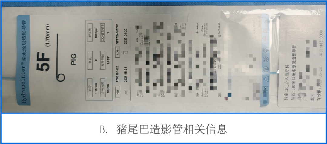 猪尾巴导管怎么拔出卒中1分钟｜脑血管造影术中常用材料（二）_https://www.jmylbn.com_新闻资讯_第5张