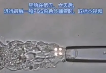 三代试管遇上「嵌合体」胚胎，是丢弃还是移植？