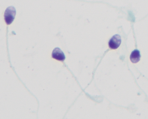 「颜值」鉴赏大会，一起看看「顶流」级别的精子长啥样！