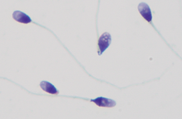 「颜值」鉴赏大会，一起看看「顶流」级别的精子长啥样！