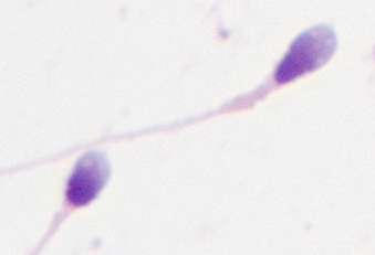 「颜值」鉴赏大会，一起看看「顶流」级别的精子长啥样！