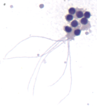 「颜值」鉴赏大会，一起看看「顶流」级别的精子长啥样！