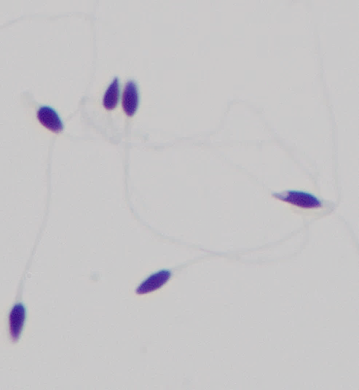 「颜值」鉴赏大会，一起看看「顶流」级别的精子长啥样！