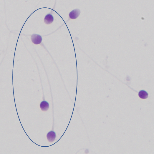 「颜值」鉴赏大会，一起看看「顶流」级别的精子长啥样！
