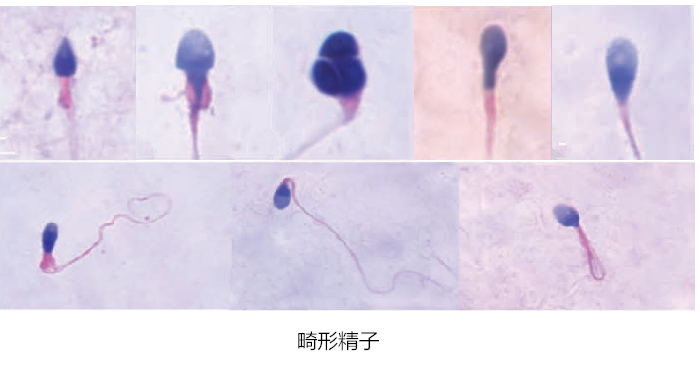 「颜值」鉴赏大会，一起看看「顶流」级别的精子长啥样！