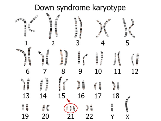男性与流产无关？这四种情况下反复胎停率极高！