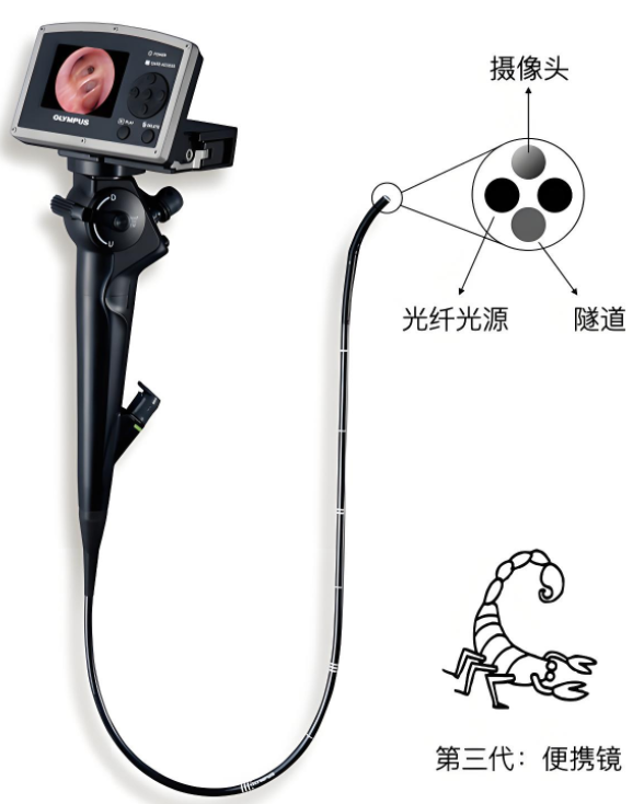 哪些内镜必须灭菌【院感周周见】ICU纤维支气管镜必须送供应室灭菌处理吗？_https://www.jmylbn.com_新闻资讯_第2张