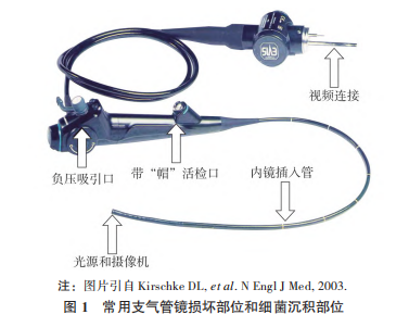 哪些内镜必须灭菌【院感周周见】ICU纤维支气管镜必须送供应室灭菌处理吗？_https://www.jmylbn.com_新闻资讯_第10张