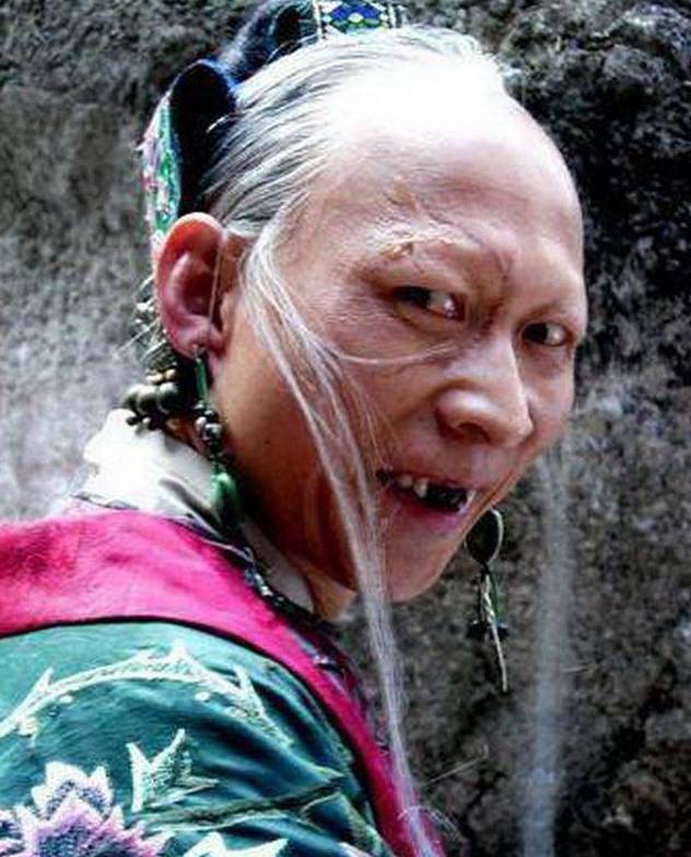 年黄晓明,刘亦菲版的《神雕侠侣》,就是那个反串饰演裘千尺的演员李明