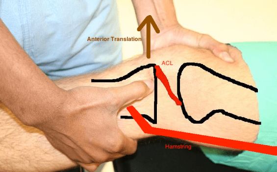 留言精选 Acl 全球康复资讯 微信公众号文章阅读 Wemp