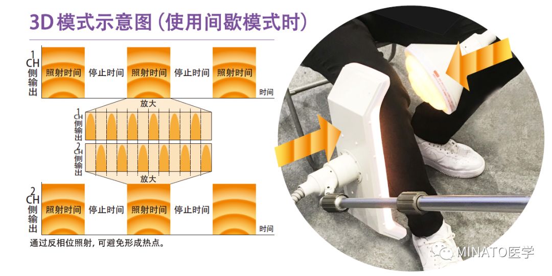 微波治疗仪怎么用三维微波治疗仪：高效安全的3D理疗模式_https://www.jmylbn.com_新闻资讯_第6张
