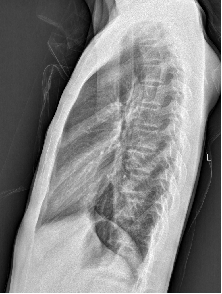 x射线为什么叫dr精准医疗，影像先行—放射检查你知多少？_https://www.jmylbn.com_新闻资讯_第12张