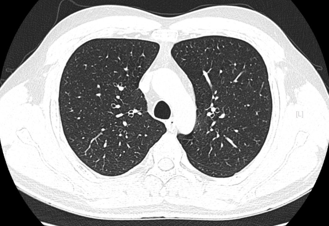 x射线为什么叫dr精准医疗，影像先行—放射检查你知多少？_https://www.jmylbn.com_新闻资讯_第15张