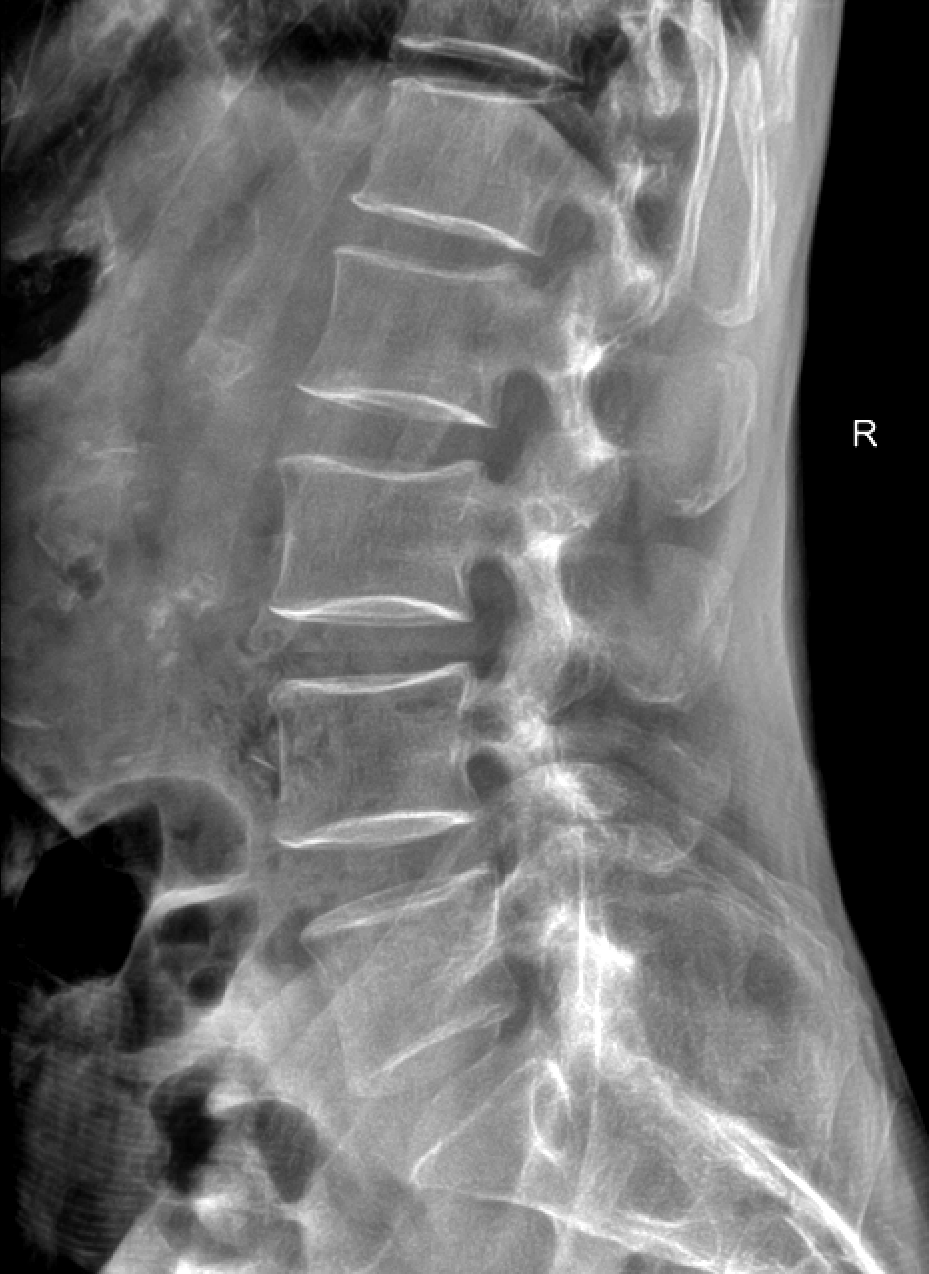 x射线为什么叫dr精准医疗，影像先行—放射检查你知多少？_https://www.jmylbn.com_新闻资讯_第10张