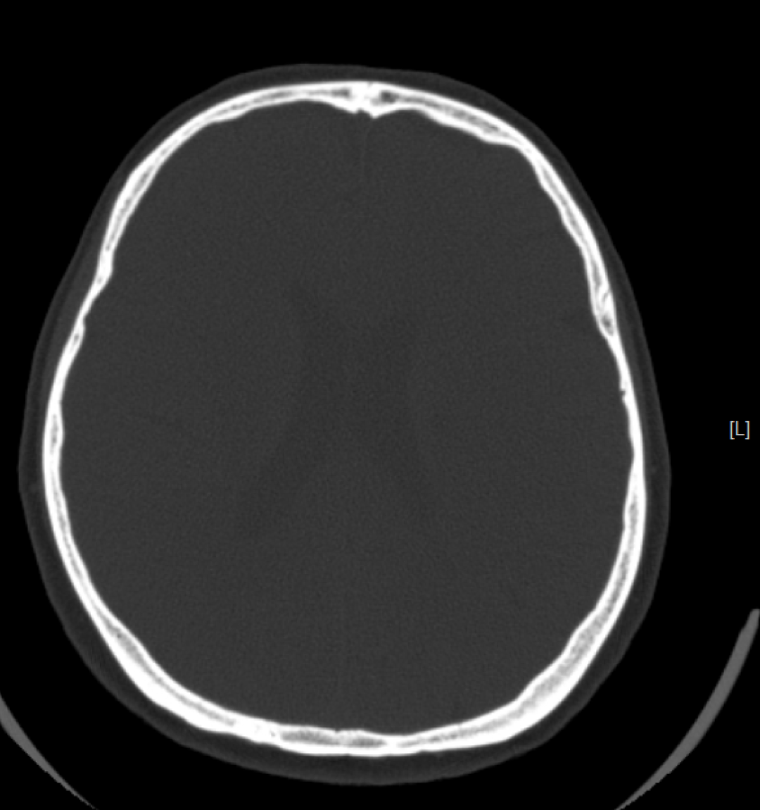x射线为什么叫dr精准医疗，影像先行—放射检查你知多少？_https://www.jmylbn.com_新闻资讯_第18张