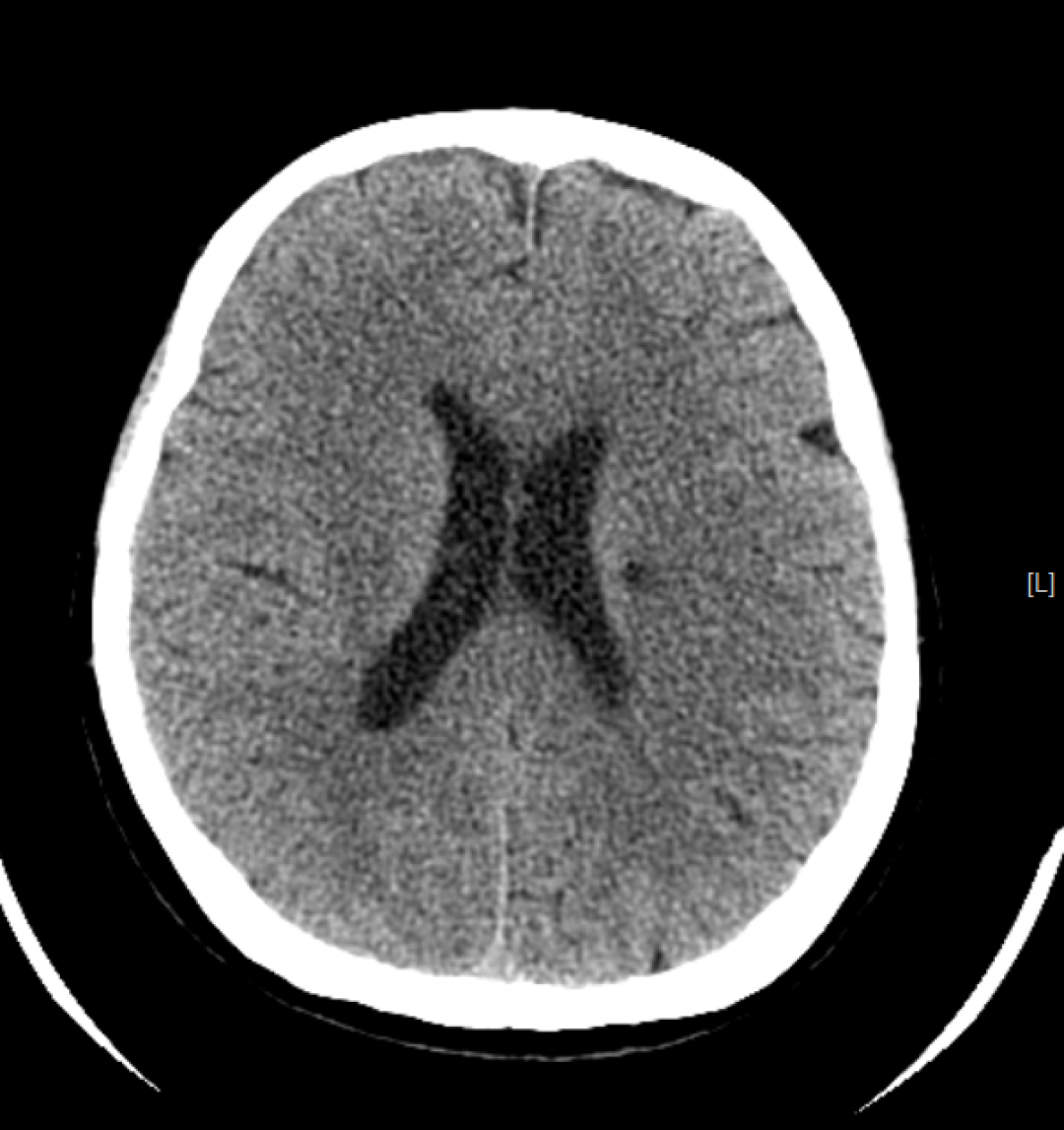x射线为什么叫dr精准医疗，影像先行—放射检查你知多少？_https://www.jmylbn.com_新闻资讯_第17张