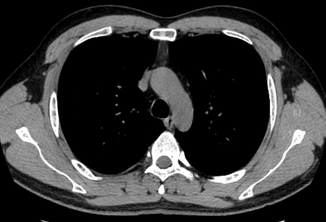 x射线为什么叫dr精准医疗，影像先行—放射检查你知多少？_https://www.jmylbn.com_新闻资讯_第16张
