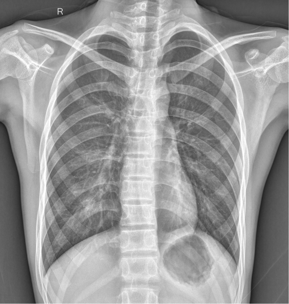 x射线为什么叫dr精准医疗，影像先行—放射检查你知多少？_https://www.jmylbn.com_新闻资讯_第11张