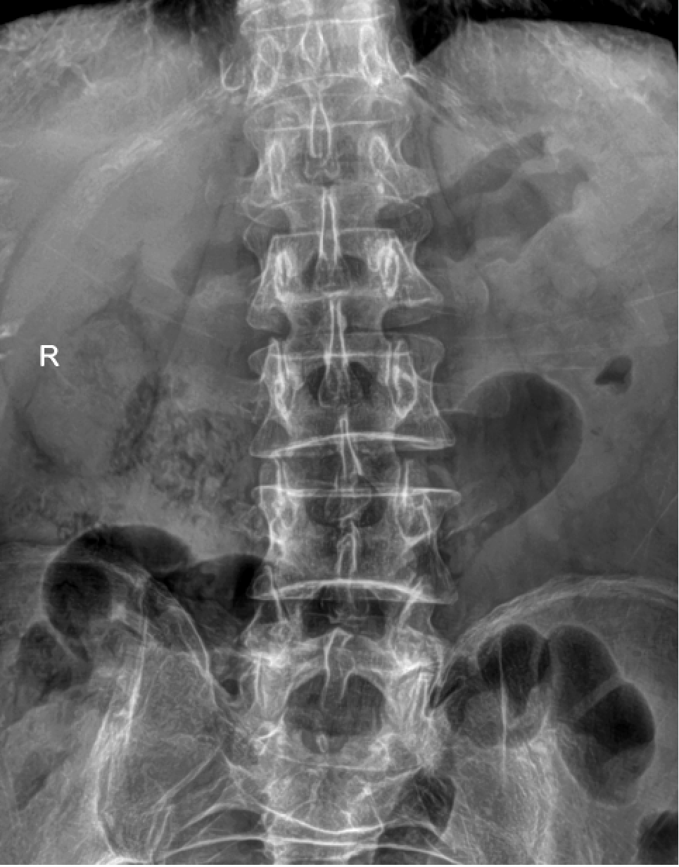 x射线为什么叫dr精准医疗，影像先行—放射检查你知多少？_https://www.jmylbn.com_新闻资讯_第9张