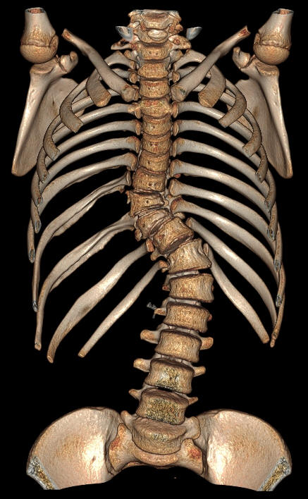 x射线为什么叫dr精准医疗，影像先行—放射检查你知多少？_https://www.jmylbn.com_新闻资讯_第20张