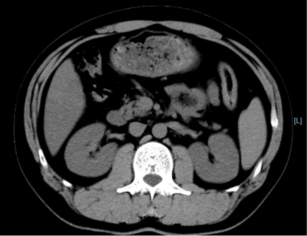 x射线为什么叫dr精准医疗，影像先行—放射检查你知多少？_https://www.jmylbn.com_新闻资讯_第21张