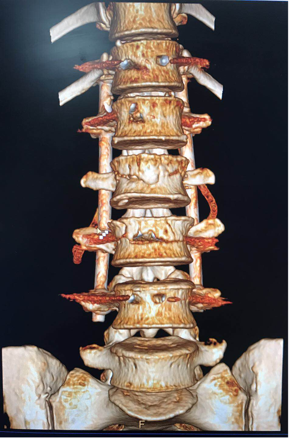 x射线为什么叫dr精准医疗，影像先行—放射检查你知多少？_https://www.jmylbn.com_新闻资讯_第19张