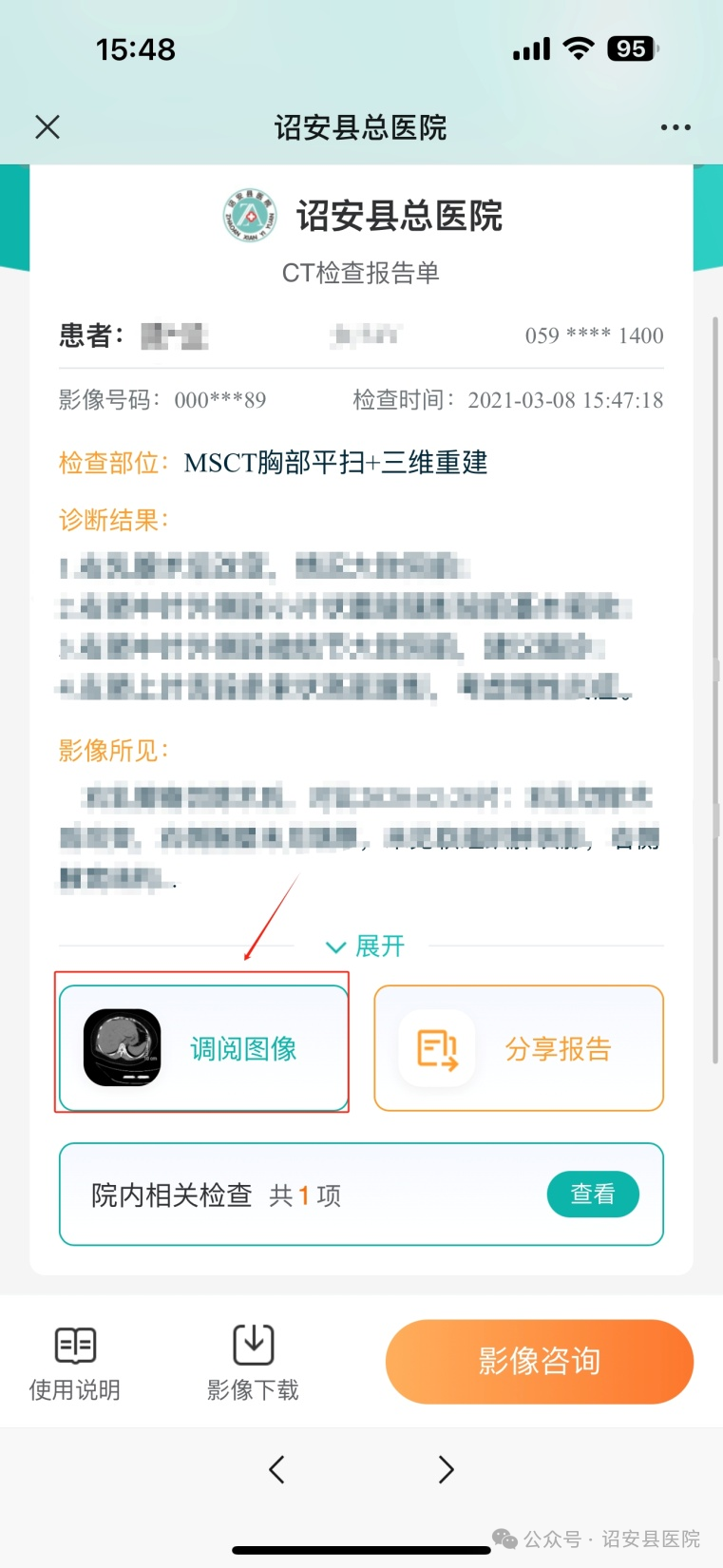为什么x光片用胶片【便民服务】诏安县医院公众号可以自助查看X光片和查阅CT、MIR检查结果啦！_https://www.jmylbn.com_新闻资讯_第17张