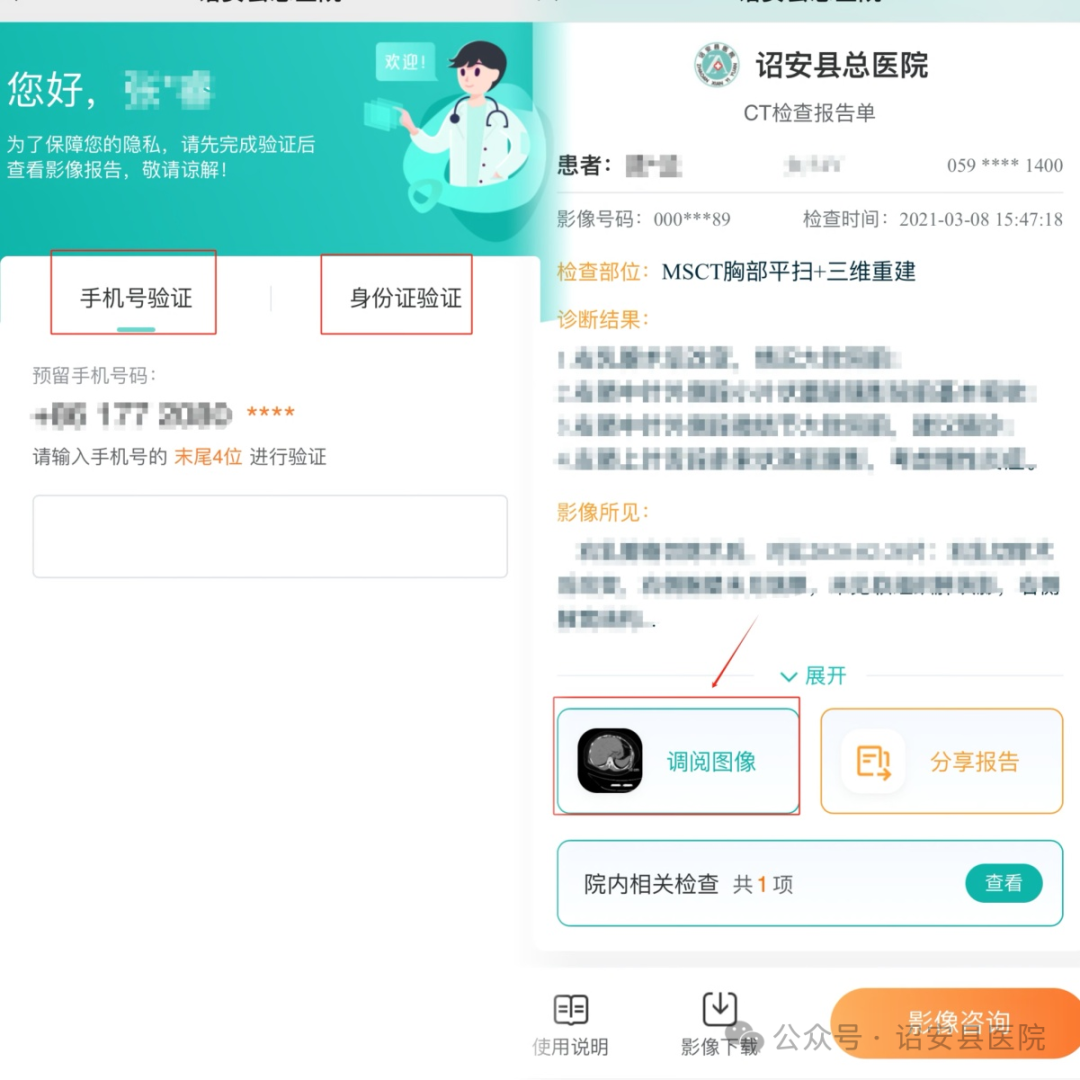 为什么x光片用胶片【便民服务】诏安县医院公众号可以自助查看X光片和查阅CT、MIR检查结果啦！_https://www.jmylbn.com_新闻资讯_第8张