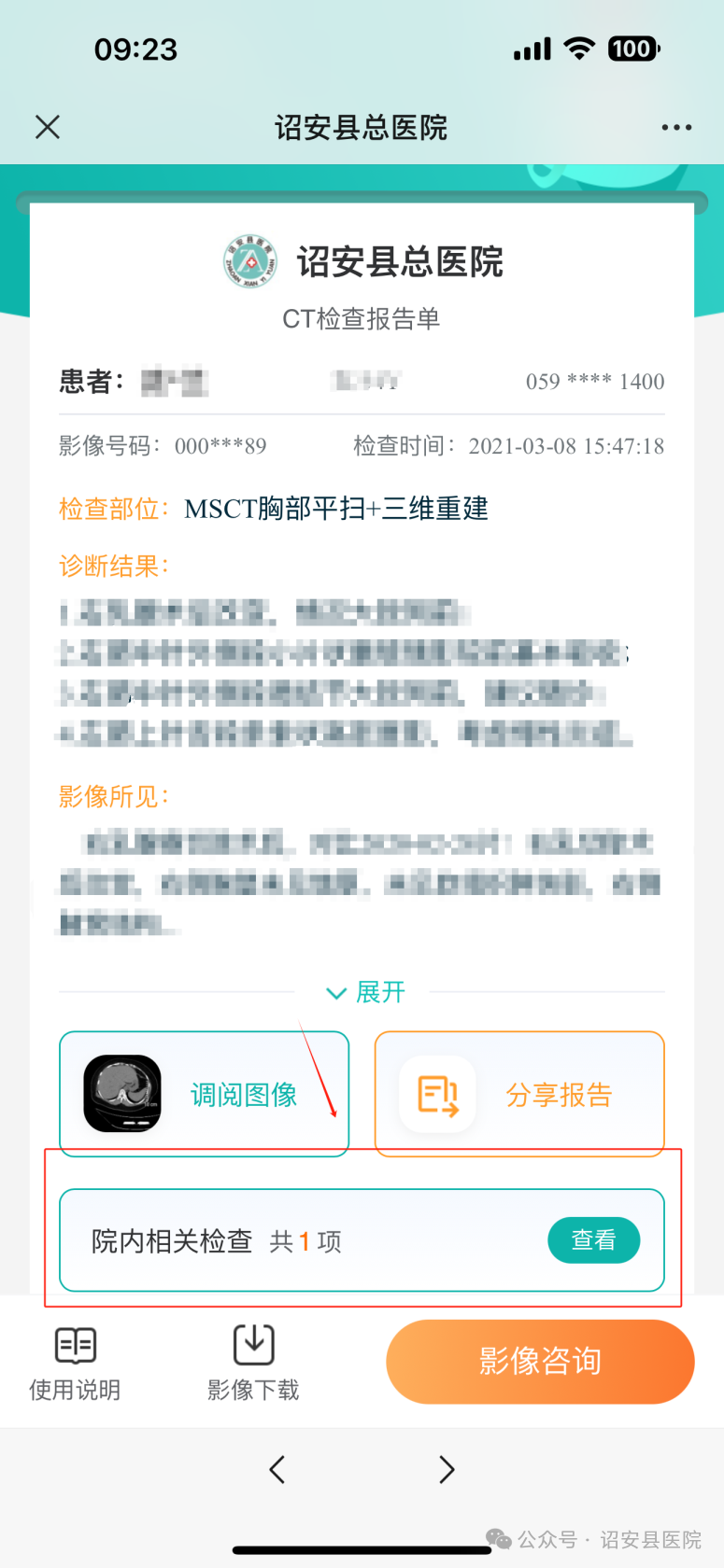 为什么x光片用胶片【便民服务】诏安县医院公众号可以自助查看X光片和查阅CT、MIR检查结果啦！_https://www.jmylbn.com_新闻资讯_第19张